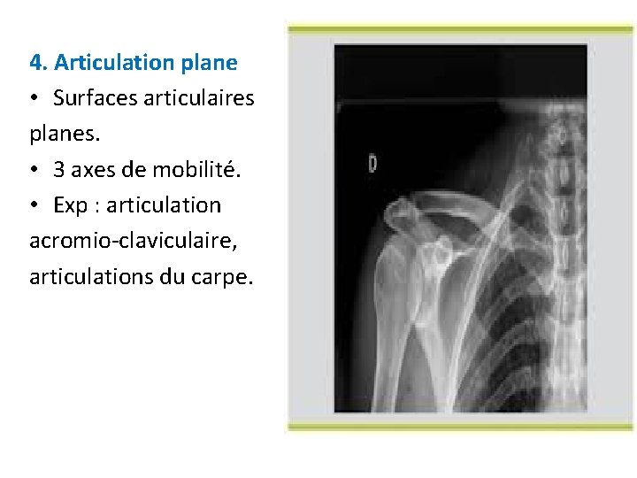 4. Articulation plane • Surfaces articulaires planes. • 3 axes de mobilité. • Exp 4. Articulation plane • Surfaces articulaires planes. • 3 axes de mobilité. • Exp