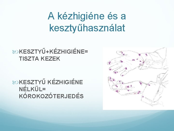 A kézhigiéne és a kesztyűhasználat KESZTYŰ+KÉZHIGIÉNE= TISZTA KEZEK KESZTYŰ KÉZHIGIÉNE NÉLKÜL= KÓROKOZÓTERJEDÉS 