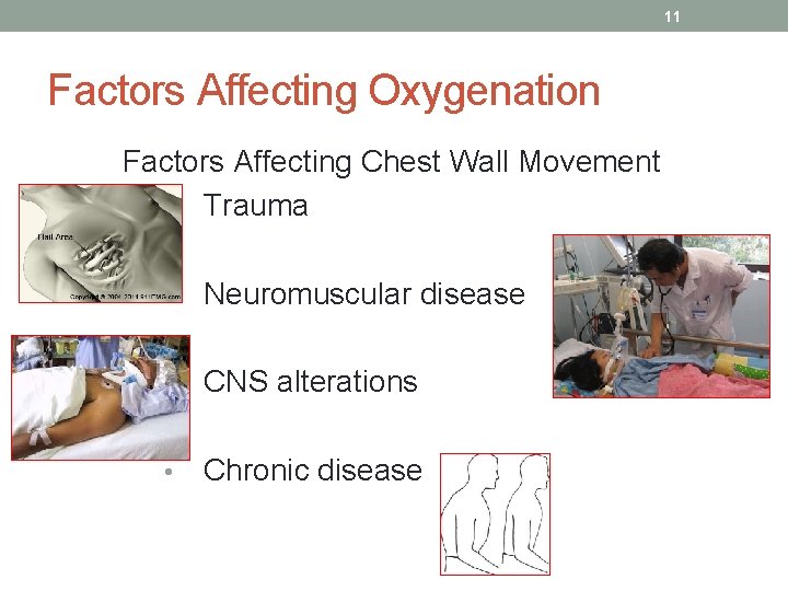 11 Factors Affecting Oxygenation Factors Affecting Chest Wall Movement • Trauma • Neuromuscular disease