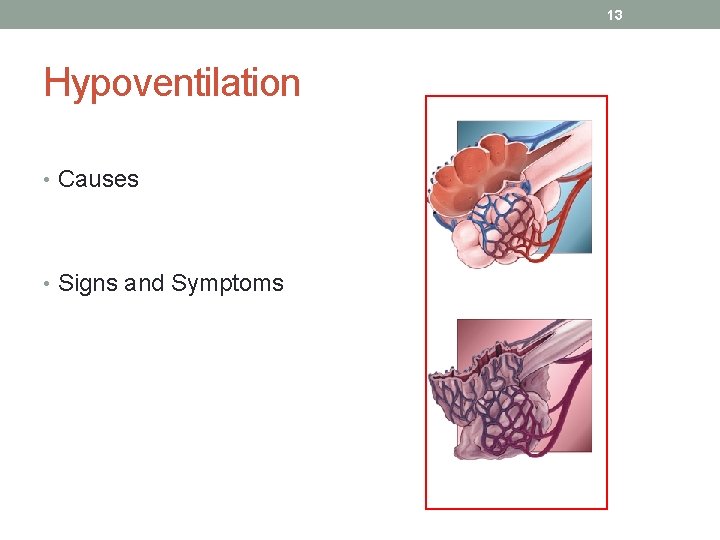 13 Hypoventilation • Causes • Signs and Symptoms 