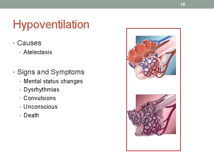 15 Hypoventilation • Causes • Atelectasis • Signs and Symptoms • Mental status changes