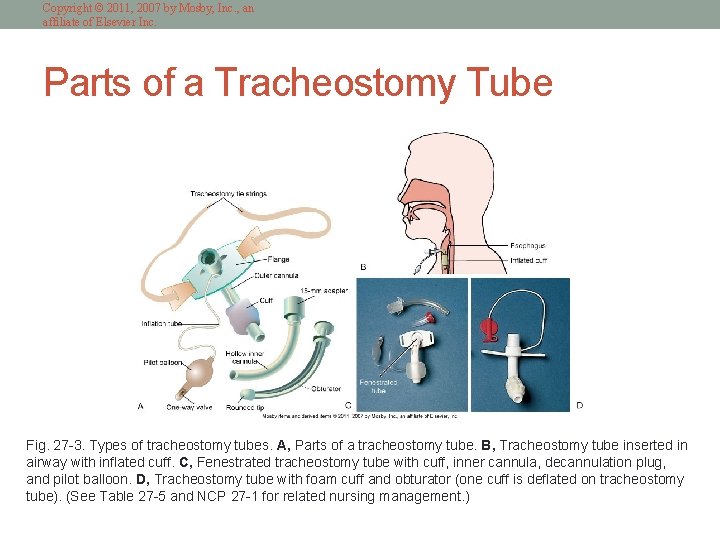 Copyright © 2011, 2007 by Mosby, Inc. , an affiliate of Elsevier Inc. Parts