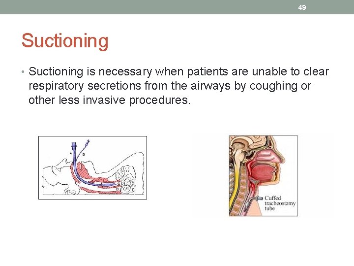 49 Suctioning • Suctioning is necessary when patients are unable to clear respiratory secretions