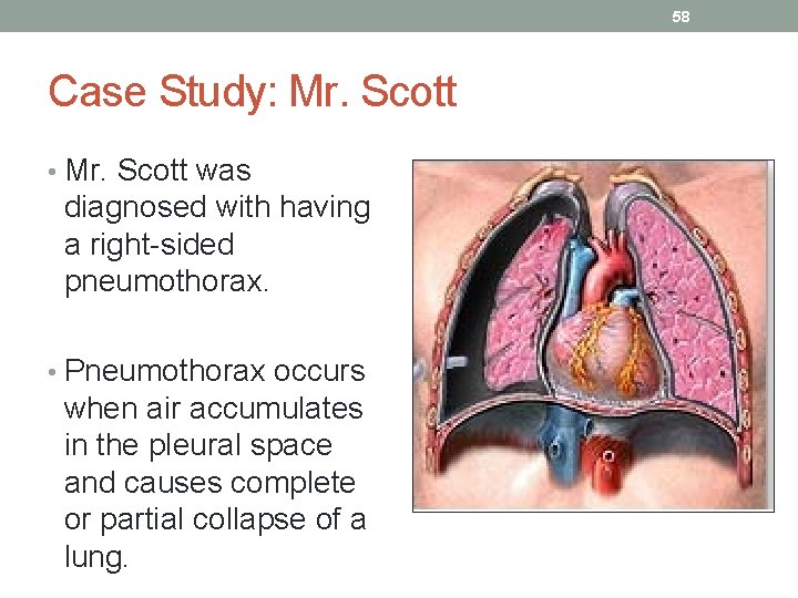 58 Case Study: Mr. Scott • Mr. Scott was diagnosed with having a right-sided