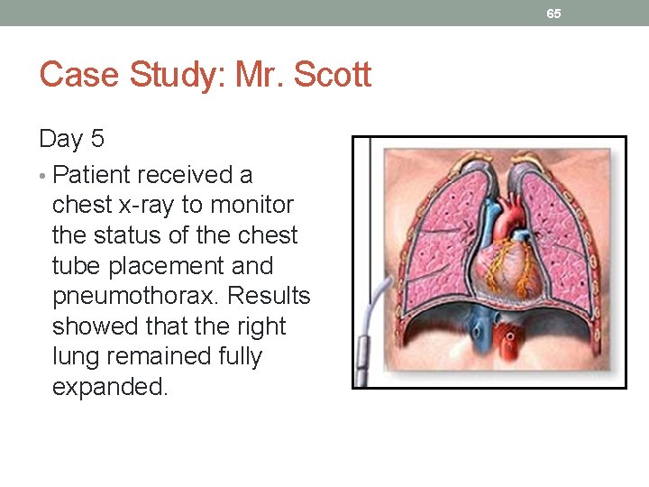 65 Case Study: Mr. Scott Day 5 • Patient received a chest x-ray to