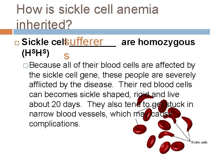 How is sickle cell anemia inherited? Sickle cellsufferer _____ are homozygous (HSHS) s �
