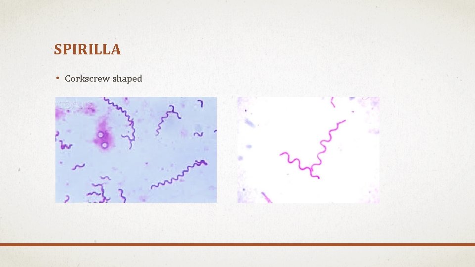 SPIRILLA • Corkscrew shaped SPIRILLA • Corkscrew shaped
