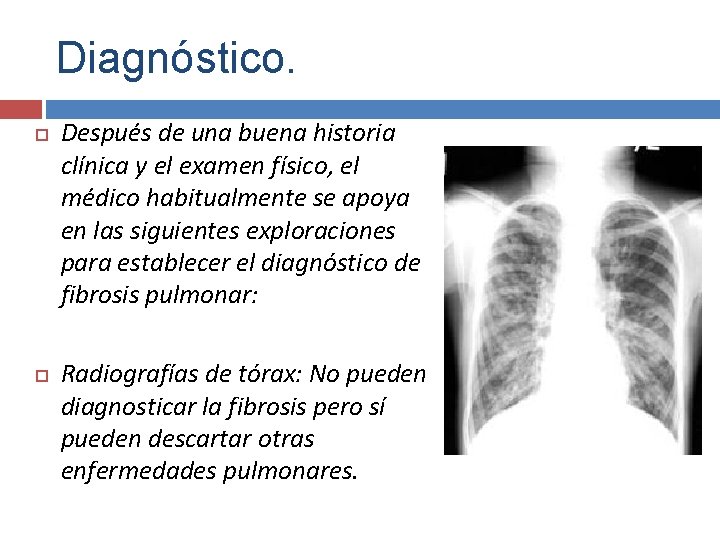 Diagnóstico. Después de una buena historia clínica y el examen físico, el médico habitualmente