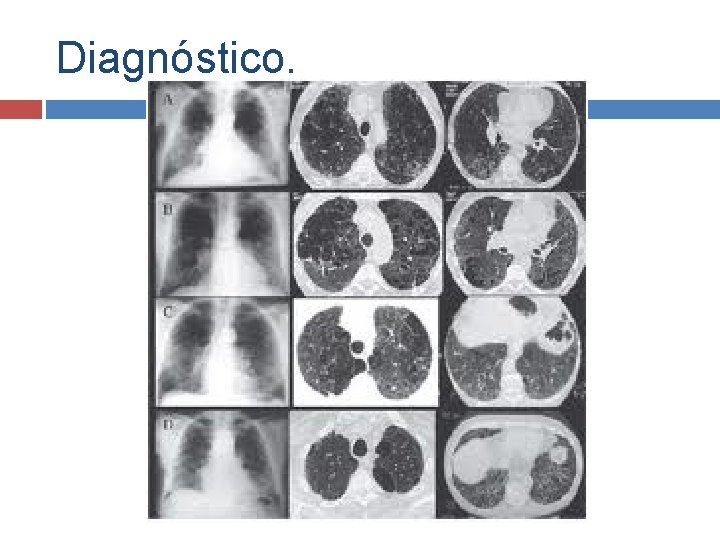 Diagnóstico. 