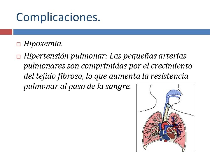 Complicaciones. Hipoxemia. Hipertensión pulmonar: Las pequeñas arterias pulmonares son comprimidas por el crecimiento del