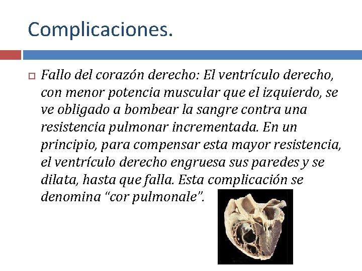 Complicaciones. Fallo del corazón derecho: El ventrículo derecho, con menor potencia muscular que el