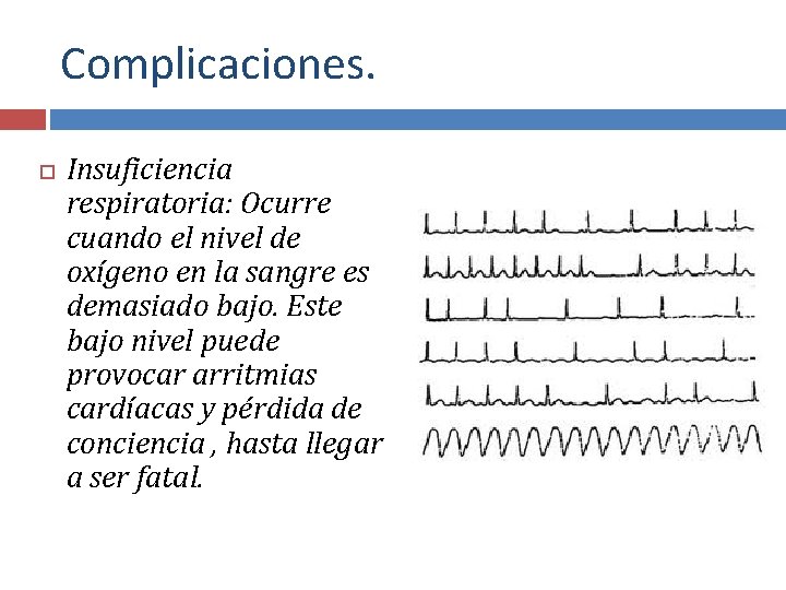 Complicaciones. Insuficiencia respiratoria: Ocurre cuando el nivel de oxígeno en la sangre es demasiado