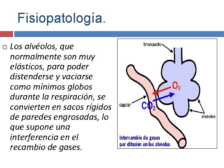 Fisiopatología. Los alvéolos, que normalmente son muy elásticos, para poder distenderse y vaciarse como