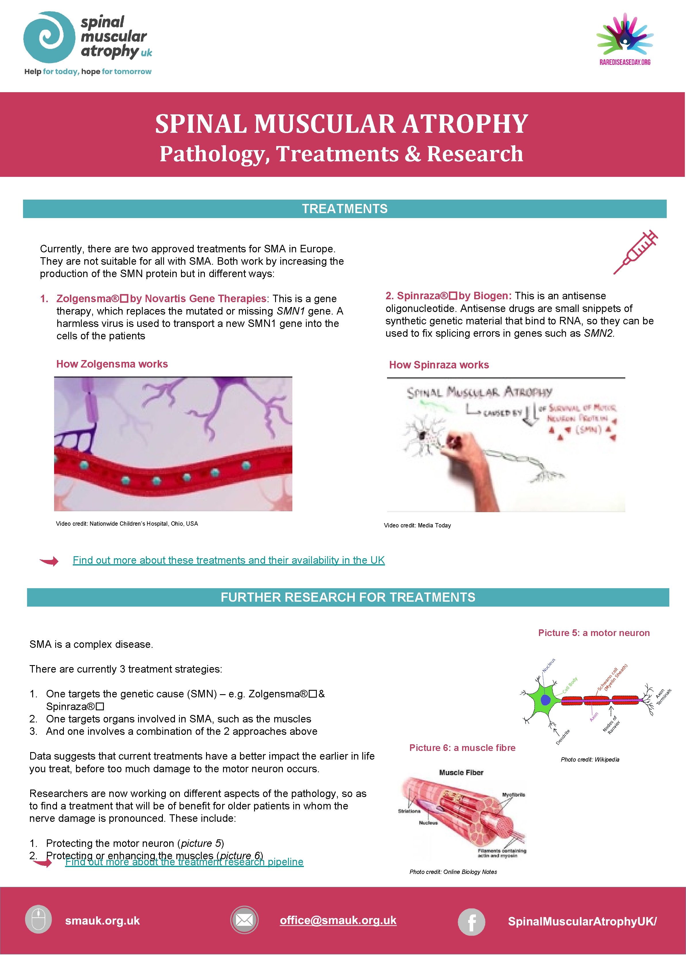 SPINAL MUSCULAR ATROPHY Pathology, Treatments & Research TREATMENTS Currently, there are two approved treatments