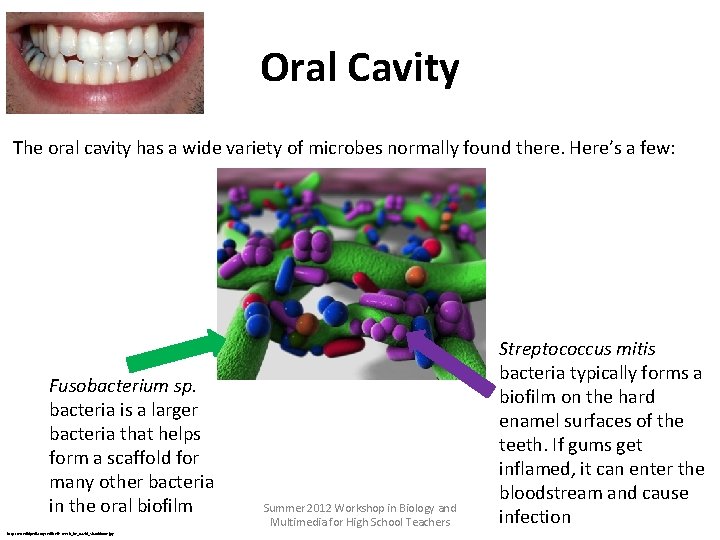 Oral Cavity The oral cavity has a wide variety of microbes normally found there.