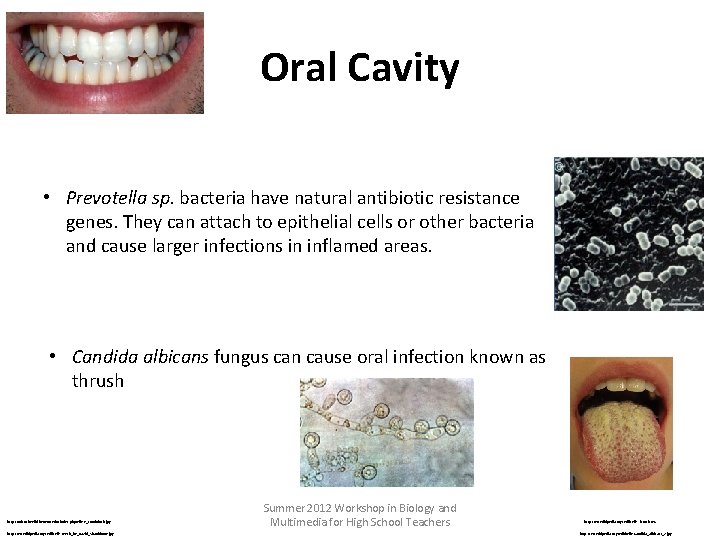Oral Cavity • Prevotella sp. bacteria have natural antibiotic resistance genes. They can attach