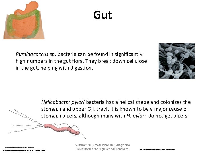 Gut Ruminococcus sp. bacteria can be found in significantly high numbers in the gut