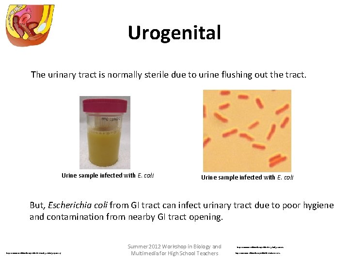 Urogenital The urinary tract is normally sterile due to urine flushing out the tract.