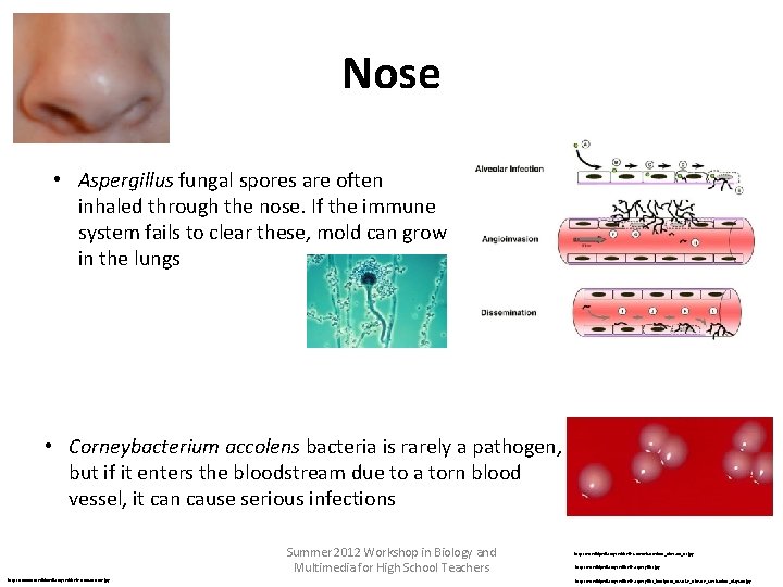 Nose • Aspergillus fungal spores are often inhaled through the nose. If the immune