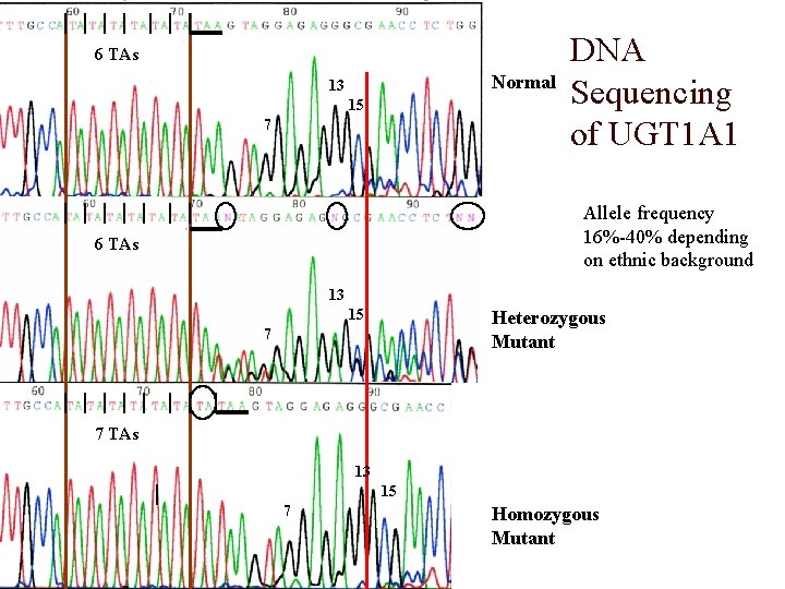 6 TAs Normal 13 15 7 o DNA Sequencing of UGT 1 A 1