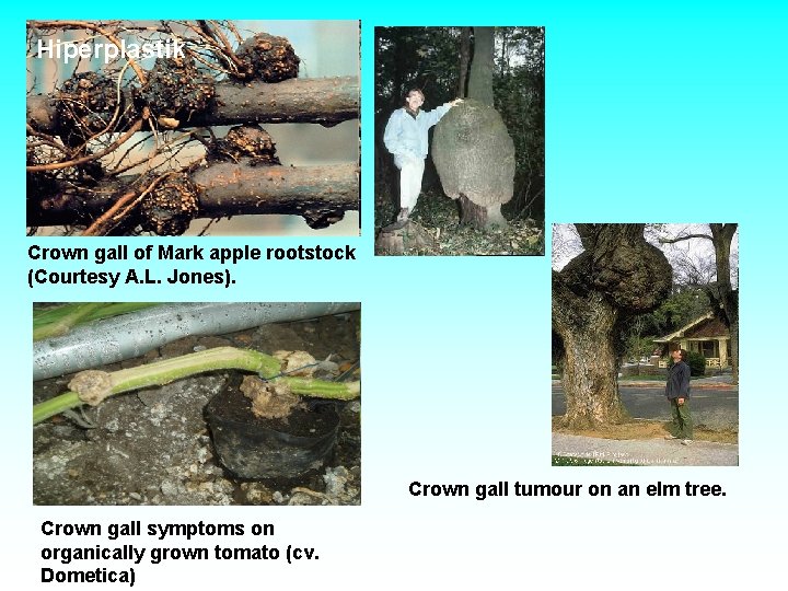Hiperplastik Crown gall of Mark apple rootstock (Courtesy A. L. Jones). Crown gall tumour Hiperplastik Crown gall of Mark apple rootstock (Courtesy A. L. Jones). Crown gall tumour