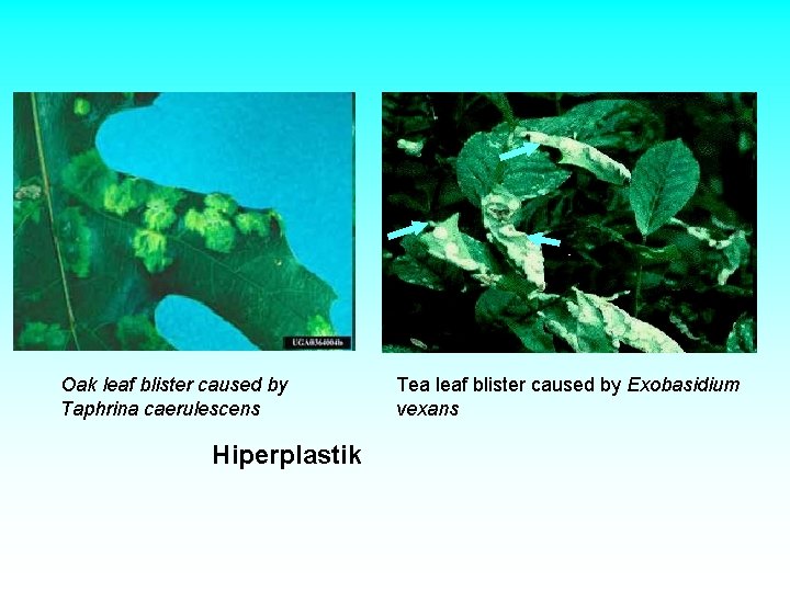 Oak leaf blister caused by Taphrina caerulescens Hiperplastik Tea leaf blister caused by Exobasidium Oak leaf blister caused by Taphrina caerulescens Hiperplastik Tea leaf blister caused by Exobasidium