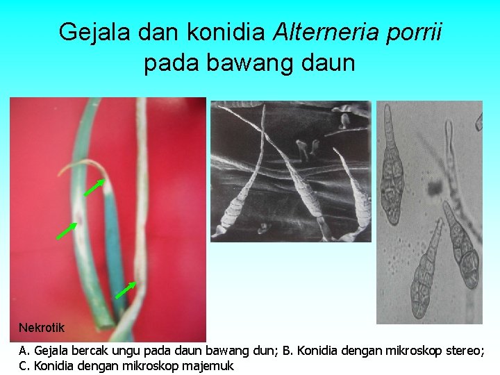 Gejala dan konidia Alterneria porrii pada bawang daun Nekrotik A. Gejala bercak ungu pada Gejala dan konidia Alterneria porrii pada bawang daun Nekrotik A. Gejala bercak ungu pada
