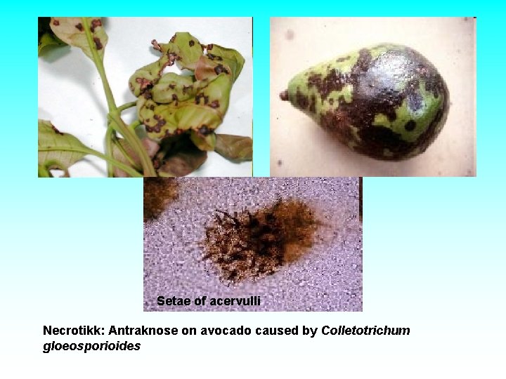 Setae of acervulli Necrotikk: Antraknose on avocado caused by Colletotrichum gloeosporioides Setae of acervulli Necrotikk: Antraknose on avocado caused by Colletotrichum gloeosporioides