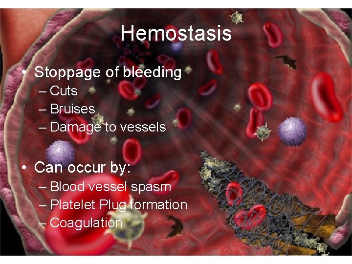 Hemostasis • Stoppage of bleeding – Cuts – Bruises – Damage to vessels •