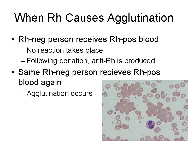 When Rh Causes Agglutination • Rh-neg person receives Rh-pos blood – No reaction takes
