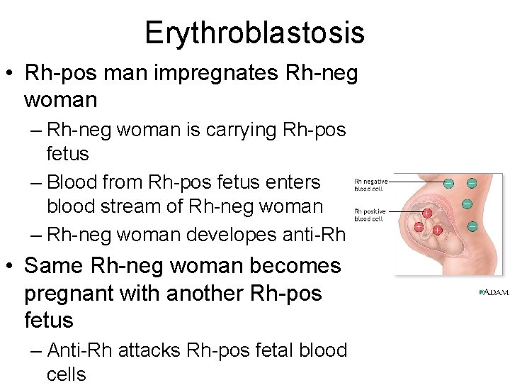 Erythroblastosis • Rh-pos man impregnates Rh-neg woman – Rh-neg woman is carrying Rh-pos fetus