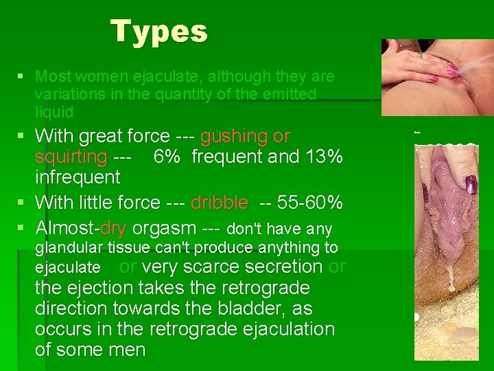 Female Ejaculation Dr Muhammad El Hennawy Obgyn specialist
