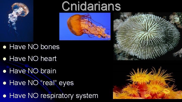 Cnidarians l Have NO bones l Have NO heart l Have NO brain l
