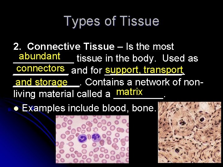 Types of Tissue 2. Connective Tissue – Is the most abundant ______ tissue in