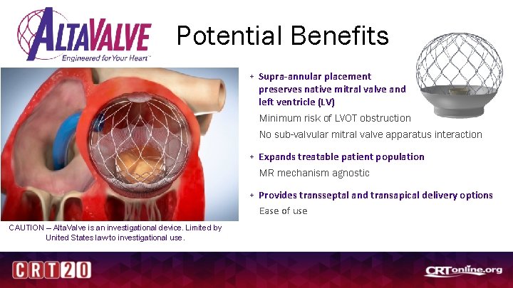Potential Benefits + Supra-annular placement preserves native mitral valve and left ventricle (LV) Minimum