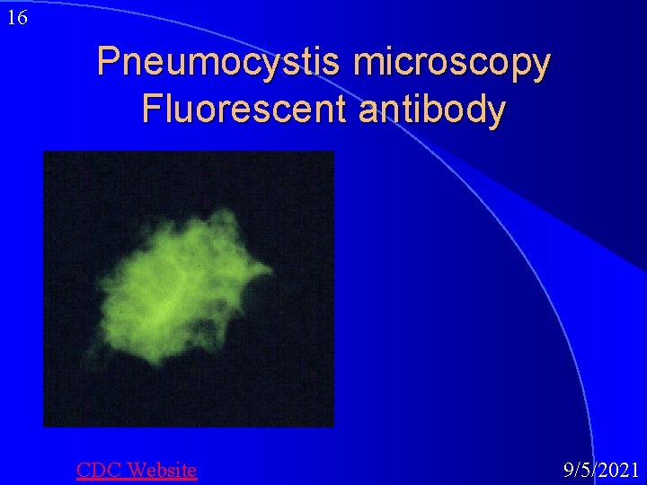 16 Pneumocystis microscopy Fluorescent antibody CDC Website 9/5/2021 