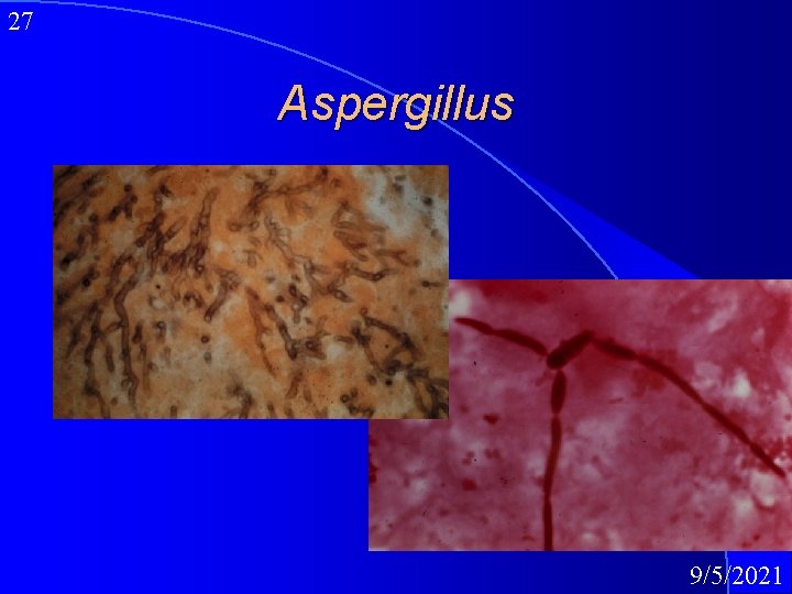 27 Aspergillus 9/5/2021 