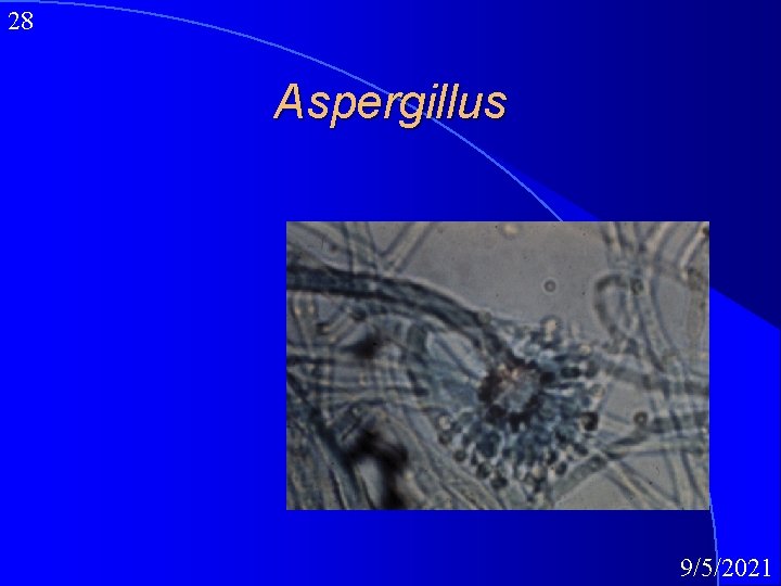 28 Aspergillus 9/5/2021 