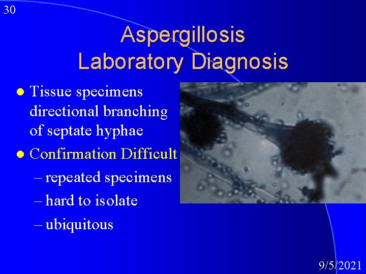 30 Aspergillosis Laboratory Diagnosis Tissue specimens directional branching of septate hyphae l Confirmation Difficult