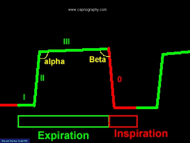 www. capnography. com Bhavani Shankar Kodali MD 