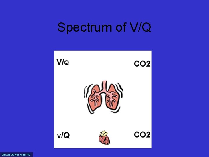 Spectrum of V/Q Bhavani Shankar Kodali MD 