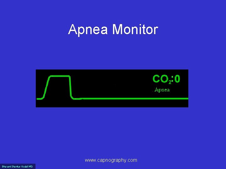 Apnea Monitor www. capnography. com Bhavani Shankar Kodali MD 