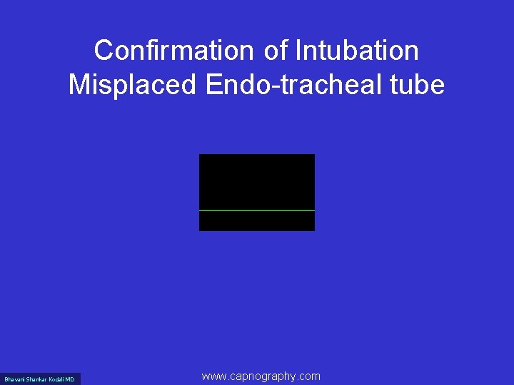 Confirmation of Intubation Misplaced Endo-tracheal tube Bhavani Shankar Kodali MD www. capnography. com 