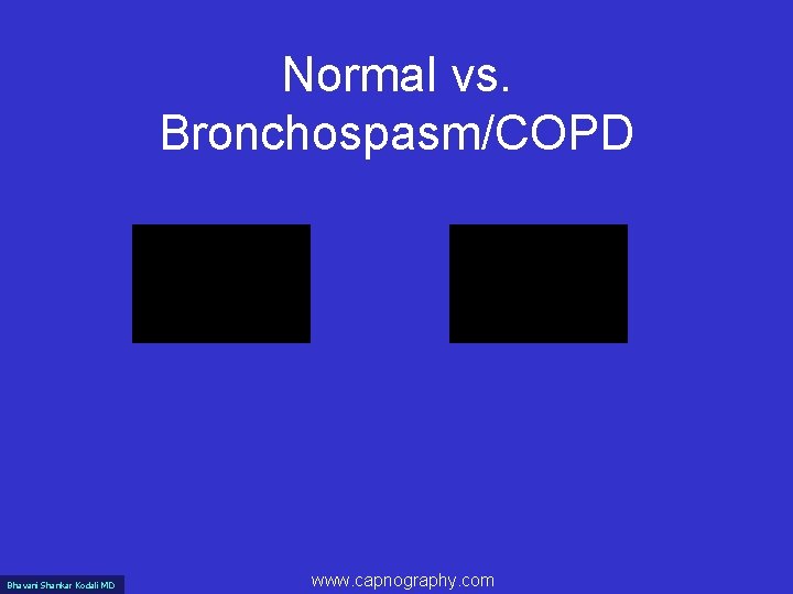 Normal vs. Bronchospasm/COPD Bhavani Shankar Kodali MD www. capnography. com 