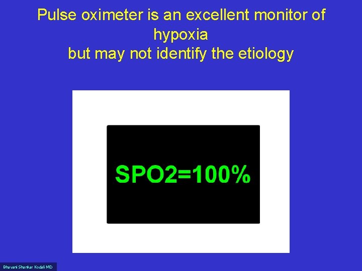 Pulse oximeter is an excellent monitor of hypoxia but may not identify the etiology