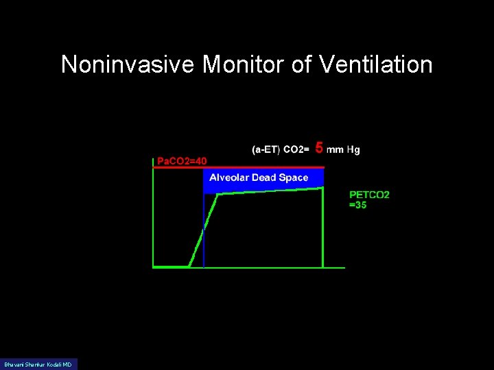 Noninvasive Monitor of Ventilation Bhavani Shankar Kodali MD 