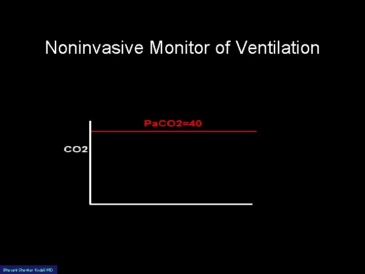 Noninvasive Monitor of Ventilation Bhavani Shankar Kodali MD 
