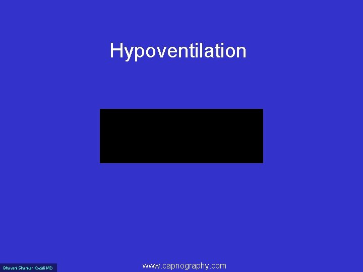 Hypoventilation Bhavani Shankar Kodali MD www. capnography. com 