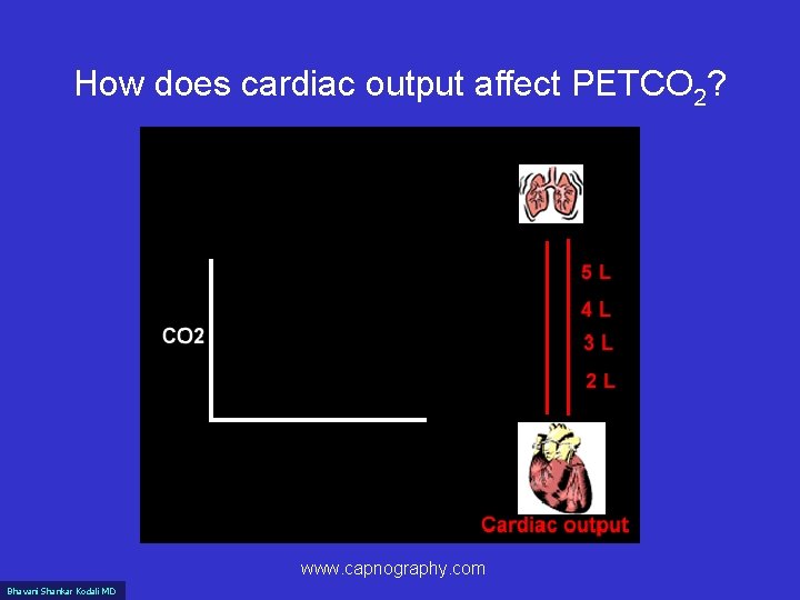 How does cardiac output affect PETCO 2? www. capnography. com Bhavani Shankar Kodali MD