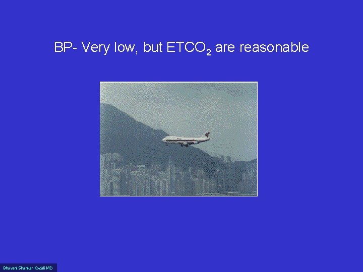 BP- Very low, but ETCO 2 are reasonable Bhavani Shankar Kodali MD 